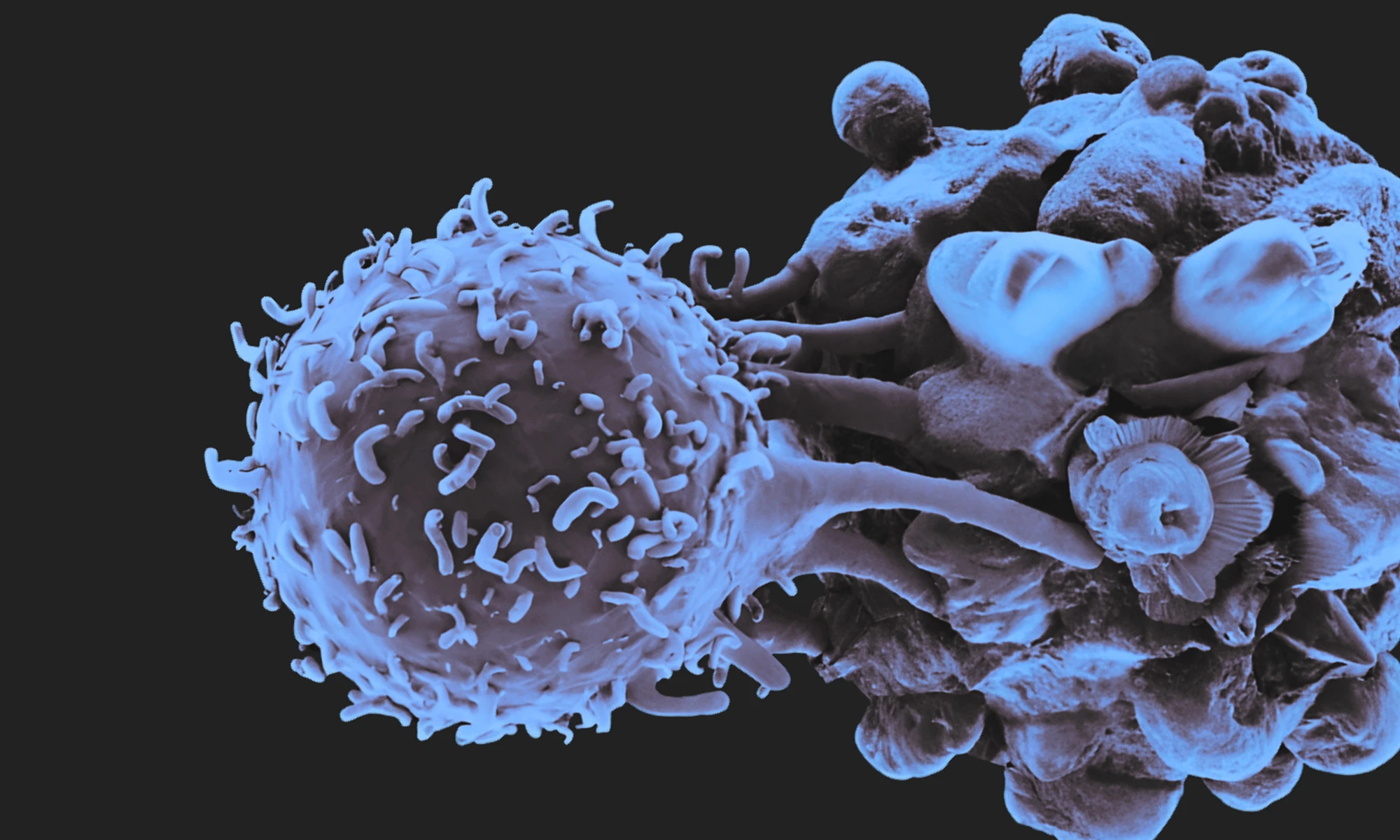 Microscopic image showing a blue fluorescent killer T cell lymphocyte attacking a cancer cell against a black background. The T cell appears above the cancer cell, its glowing structure highlighting the immune response in action.